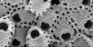 bone microscopy image